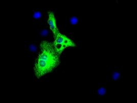 AFP Antibody in Immunocytochemistry (ICC/IF)