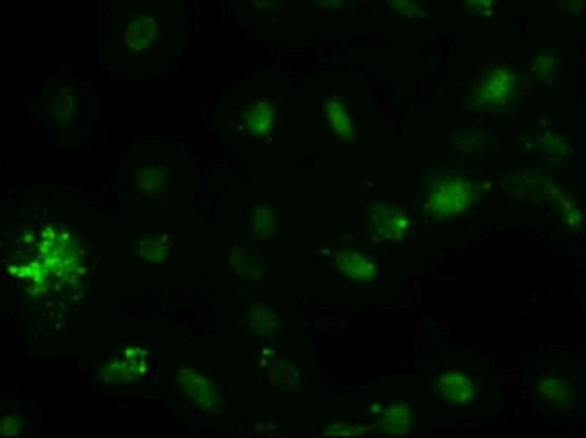 AFP Antibody in Immunocytochemistry (ICC/IF)