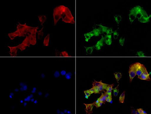 AFP Antibody in Immunocytochemistry (ICC/IF)