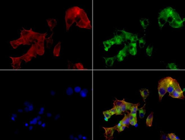 AFP Antibody in Immunocytochemistry (ICC/IF)