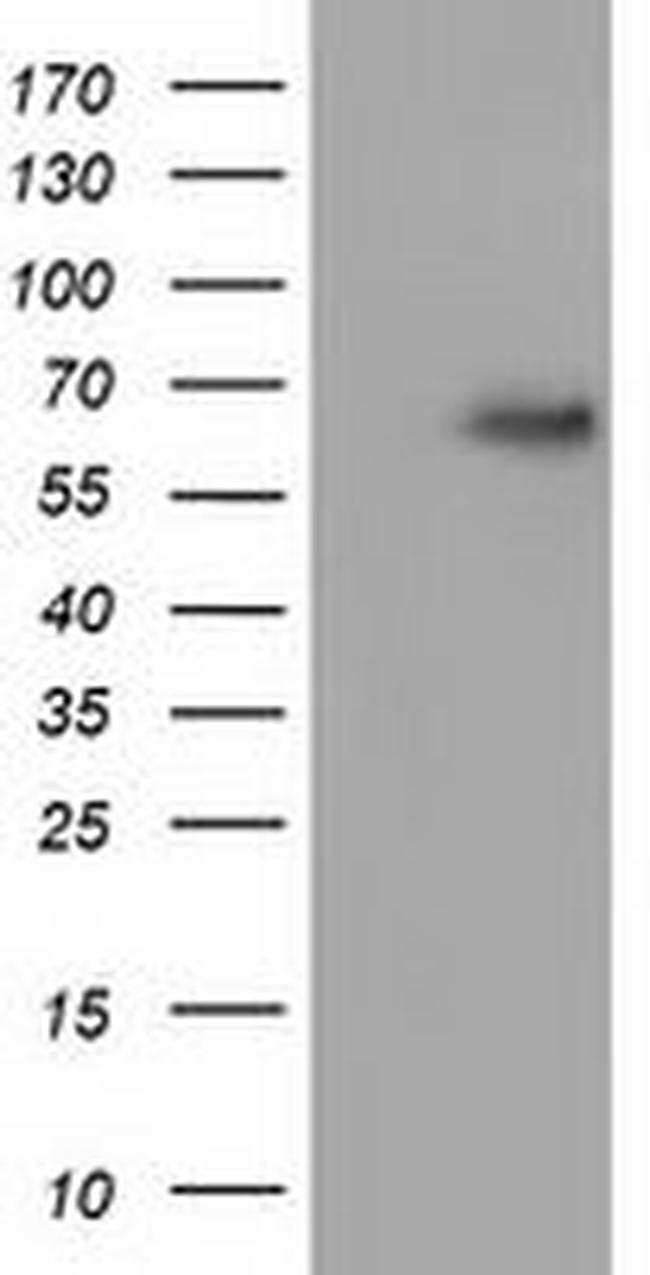 AFP Antibody in Western Blot (WB)