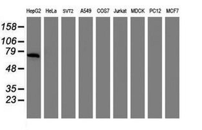 AFP Antibody in Western Blot (WB)