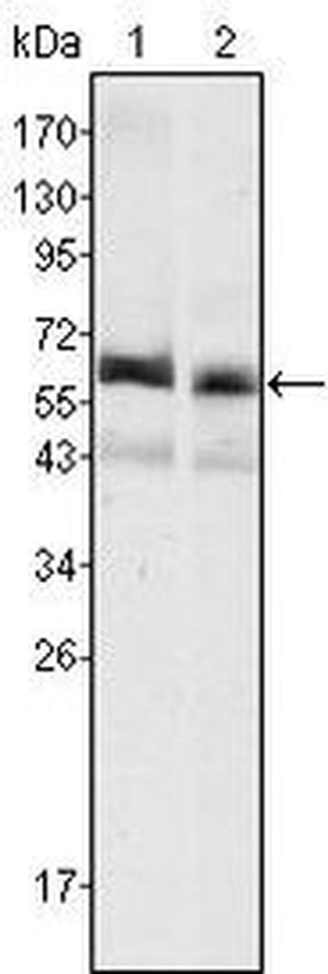 AFP Antibody in Western Blot (WB)
