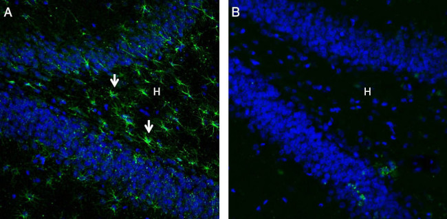 GPR43/FFAR2 Antibody in Immunohistochemistry (Frozen) (IHC (F))