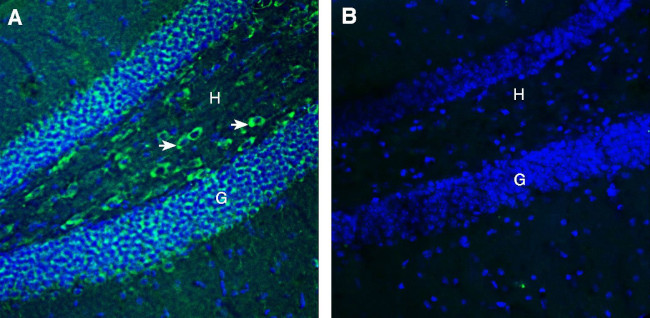 FLRT3 (extracellular) Antibody in Immunohistochemistry (Frozen) (IHC (F))