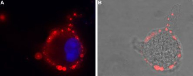GABA(A) epsilon Receptor (GABRE) (extracellular) Antibody in Immunocytochemistry (ICC/IF)