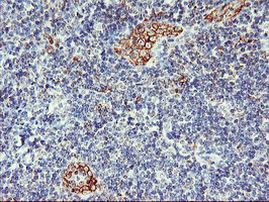 AGAP1 Antibody in Immunohistochemistry (Paraffin) (IHC (P))