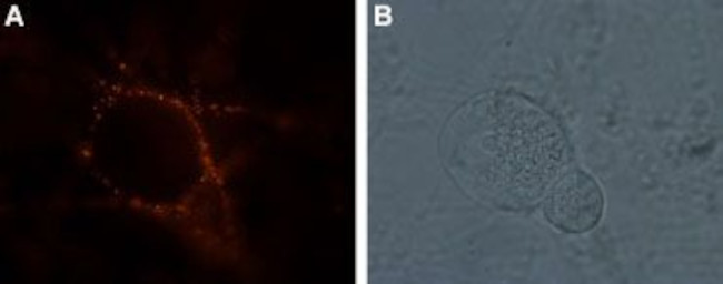 GRIK1 (GluK1) (extracellular) Antibody in Immunocytochemistry (ICC/IF)