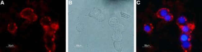 mGluR4 (extracellular) Antibody in Immunocytochemistry (ICC/IF)