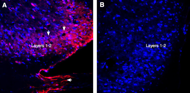 VGLUT1 Antibody in Immunohistochemistry (Frozen) (IHC (F))