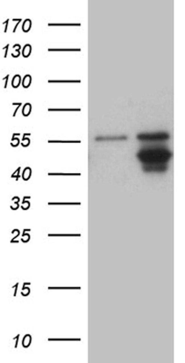 AGPAT9 Antibody in Western Blot (WB)