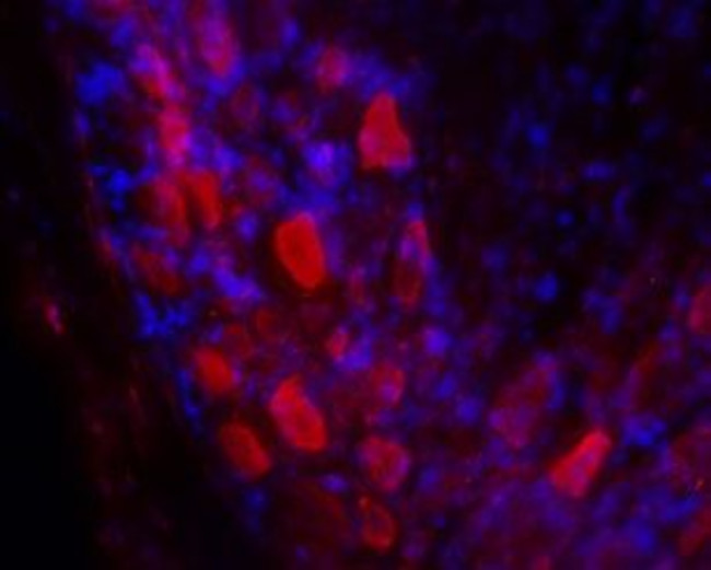 GALR2 Antibody in Immunohistochemistry (Frozen) (IHC (F))
