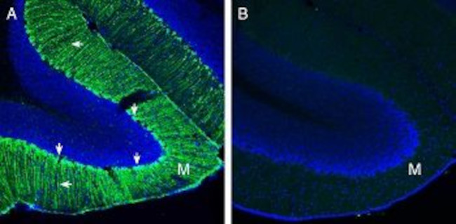 Secretin Receptor (extracellular) Antibody in Immunohistochemistry (Frozen) (IHC (F))
