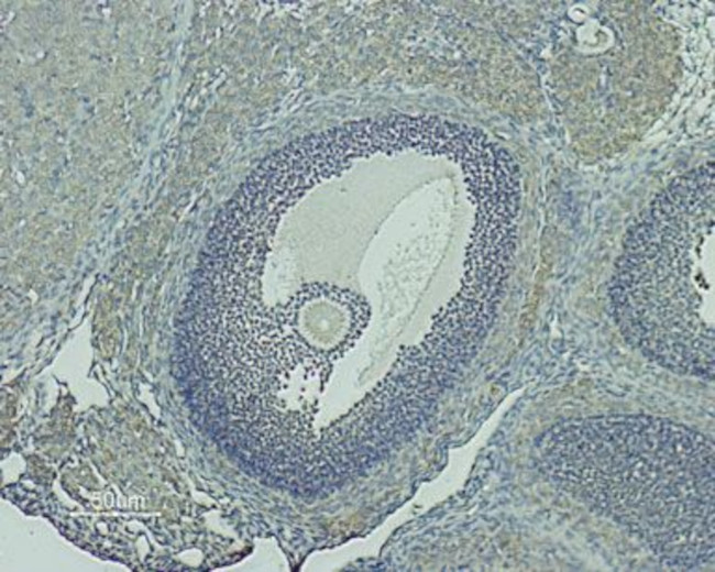 GnRH Receptor (extracellular) Antibody in Immunohistochemistry (Paraffin) (IHC (P))