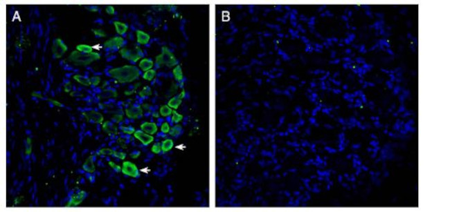 GPR35 (extracellular) Antibody in Immunohistochemistry (Frozen) (IHC (F))