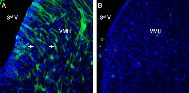 GPR139 Antibody in Immunohistochemistry (Frozen) (IHC (F))