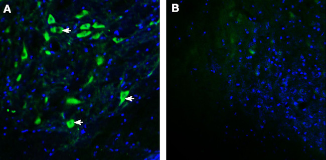 GPRC5B Antibody in Immunohistochemistry (Frozen) (IHC (F))