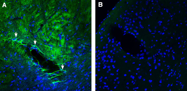 GPR143 Antibody in Immunohistochemistry (Frozen) (IHC (F))
