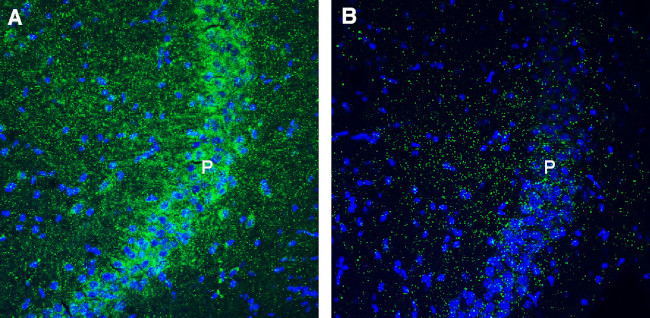 GPR160 Antibody in Immunohistochemistry (Frozen) (IHC (F))