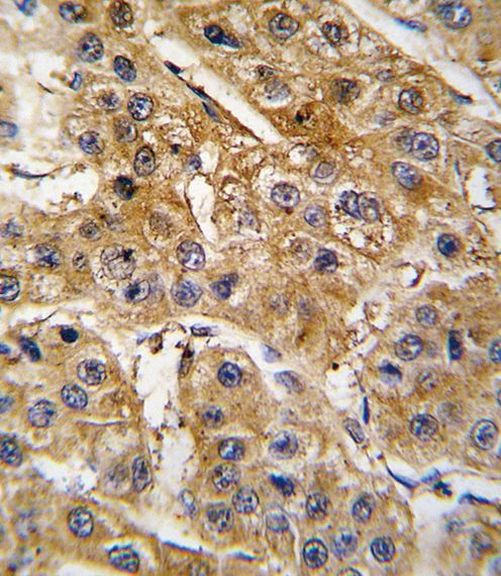 Angiotensinogen Antibody in Immunohistochemistry (IHC)