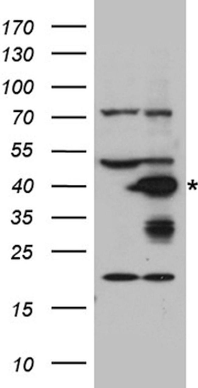 AGXT Antibody in Western Blot (WB)