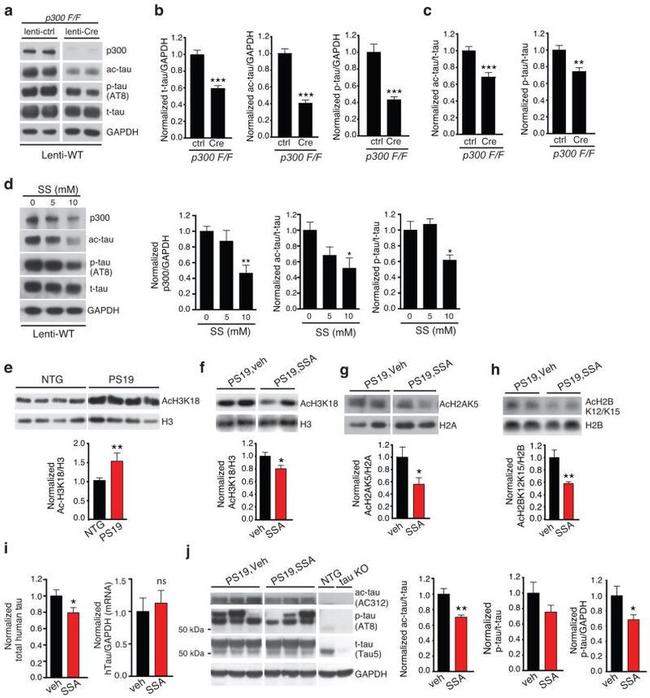 Tau Antibody in Western Blot, ELISA (WB, ELISA)