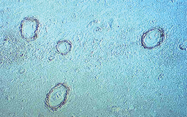 beta Amyloid (N-terminal) Antibody in Immunohistochemistry (Paraffin) (IHC (P))