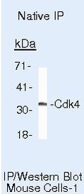 Cyclin D1 Antibody in Immunoprecipitation (IP)