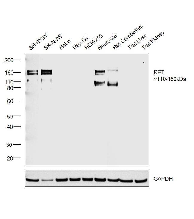 RET Antibody in Western Blot (WB)