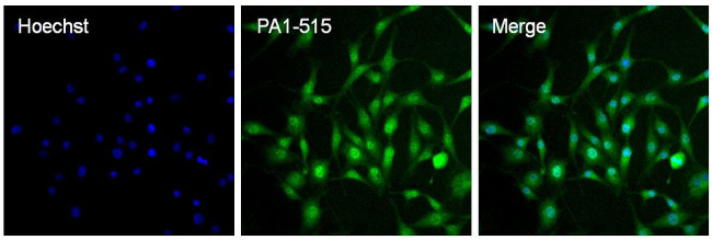 ARNT Antibody in Immunocytochemistry (ICC/IF)
