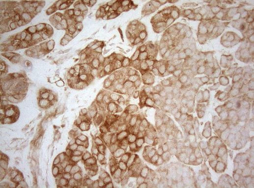 AHSA1 Antibody in Immunohistochemistry (Paraffin) (IHC (P))