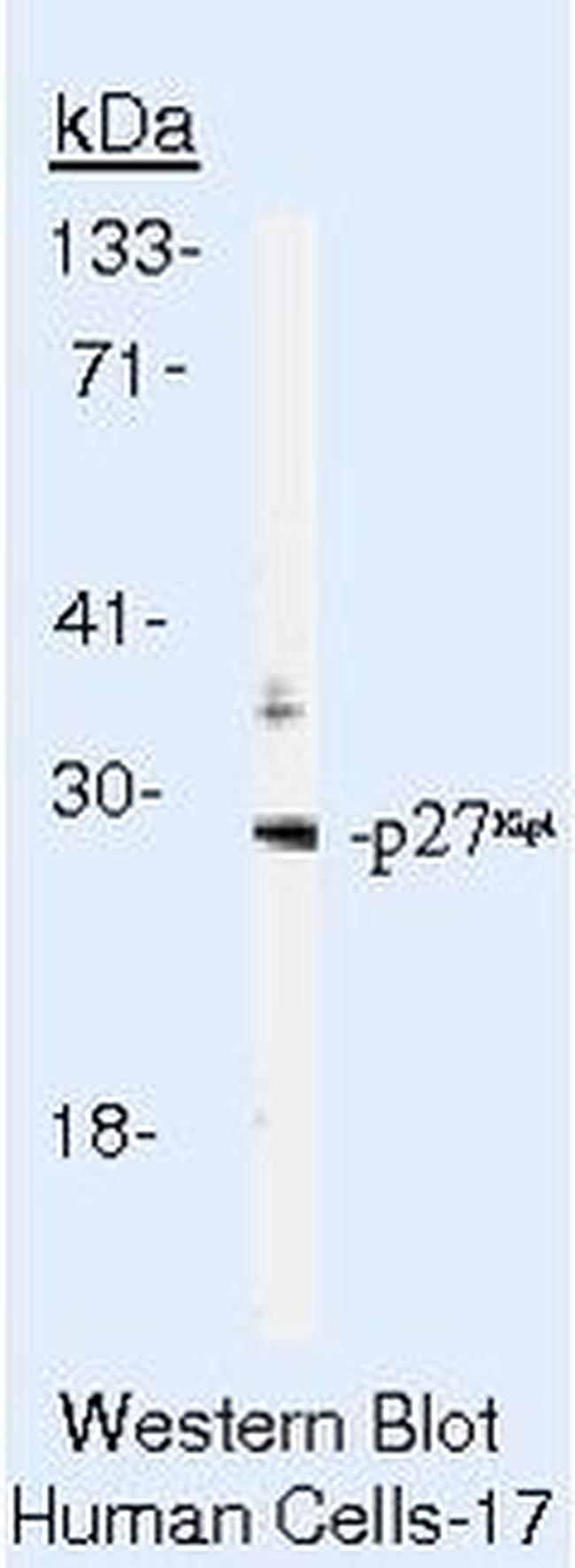 p27 Kip1 Antibody in Western Blot (WB)