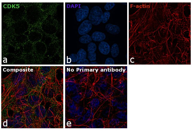 CDK5 Antibody in Immunocytochemistry (ICC/IF)