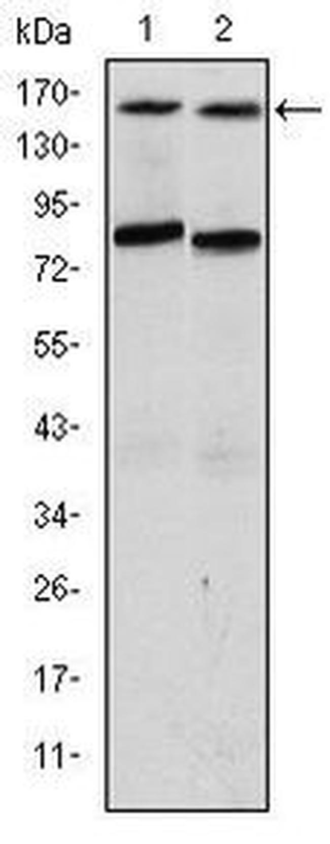 SRC3 Antibody in Western Blot (WB)