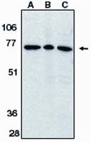 AIF Antibody in Western Blot (WB)