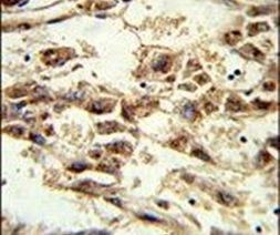 AMID Antibody in Immunohistochemistry (IHC)