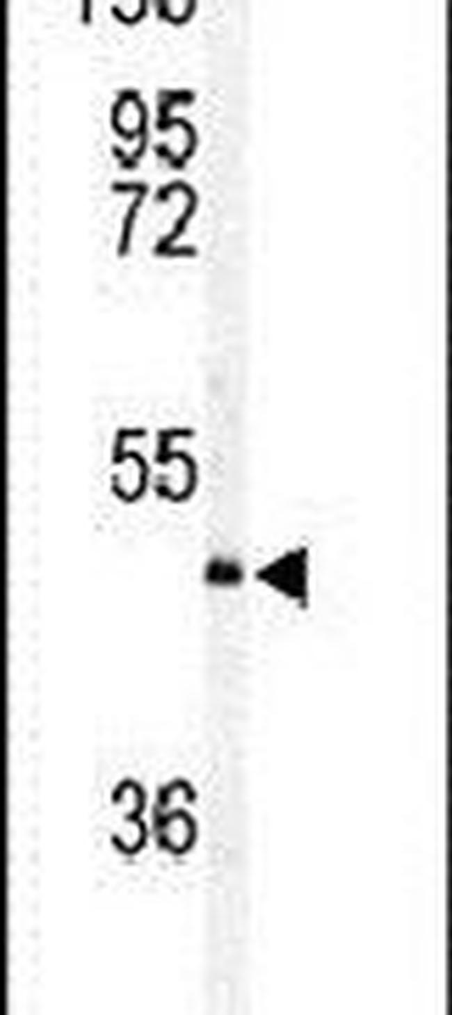 AMID Antibody in Western Blot (WB)