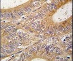 Aurora A Antibody in Immunohistochemistry (IHC)