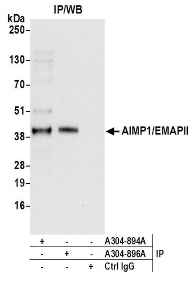 AIMP1/EMAPII/SCYE1 Antibody in Immunoprecipitation (IP)