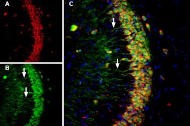 Presenilin-1 Antibody in Multiplex Immunohistochemistry (mIHC)