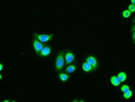 AK1 Antibody in Immunocytochemistry (ICC/IF)