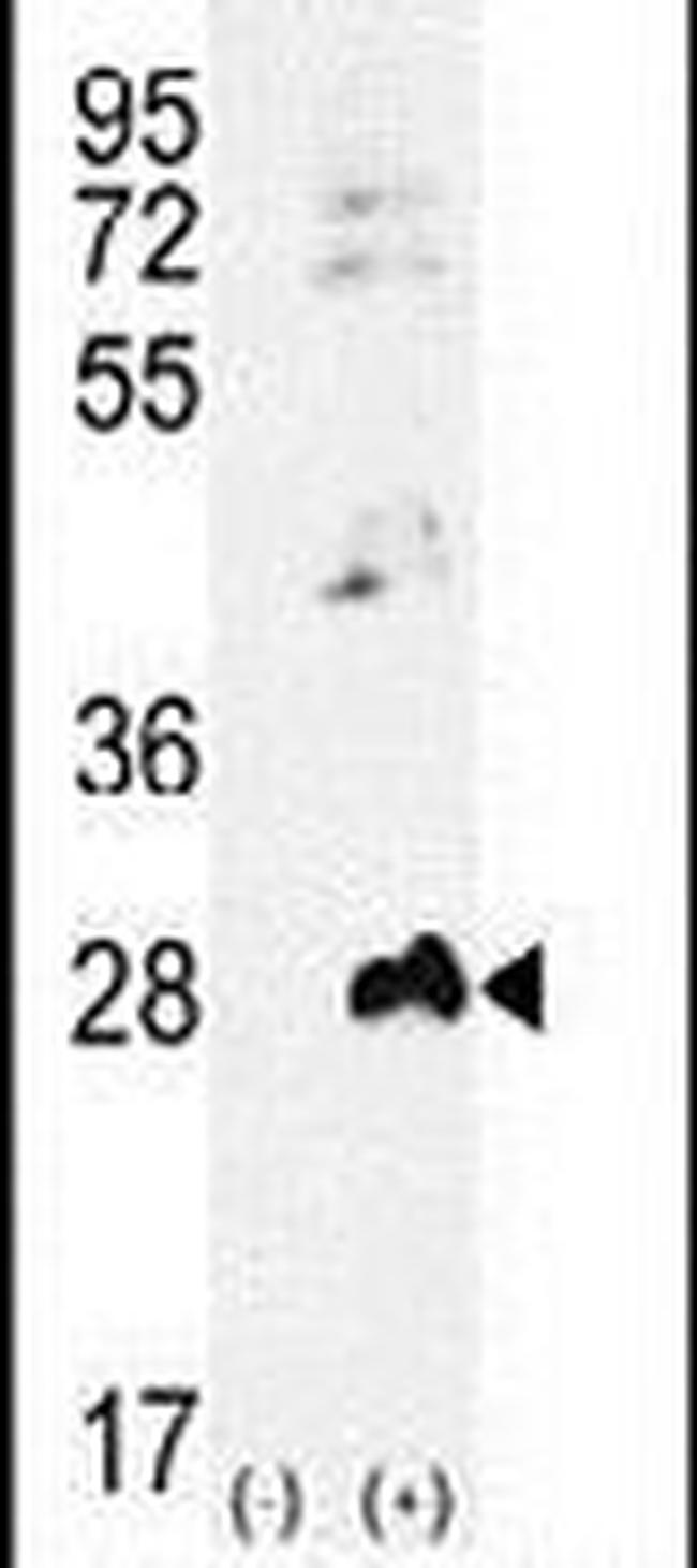 Adenylate Kinase 1 Antibody in Western Blot (WB)