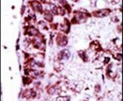 Adenylate Kinase 2 Antibody in Immunohistochemistry (IHC)