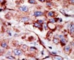 Adenylate Kinase 2 Antibody in Immunohistochemistry (IHC)