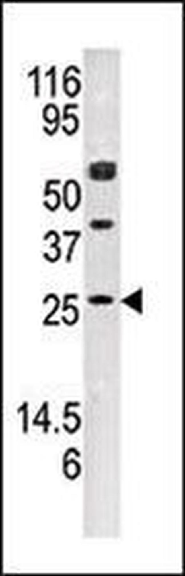Adenylate Kinase 3 Antibody in Western Blot (WB)