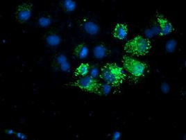 AK4 Antibody in Immunocytochemistry (ICC/IF)