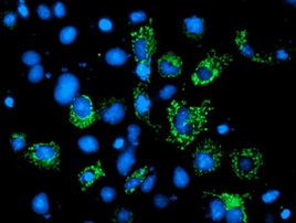 AK4 Antibody in Immunocytochemistry (ICC/IF)