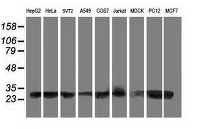 AK4 Antibody in Western Blot (WB)