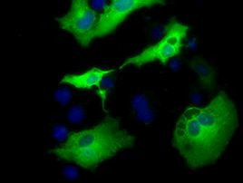 AK5 Antibody in Immunocytochemistry (ICC/IF)