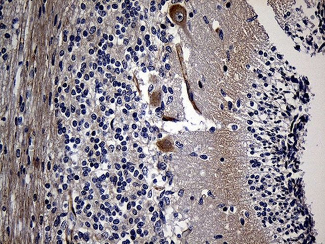 AKAP12 Antibody in Immunohistochemistry (Paraffin) (IHC (P))